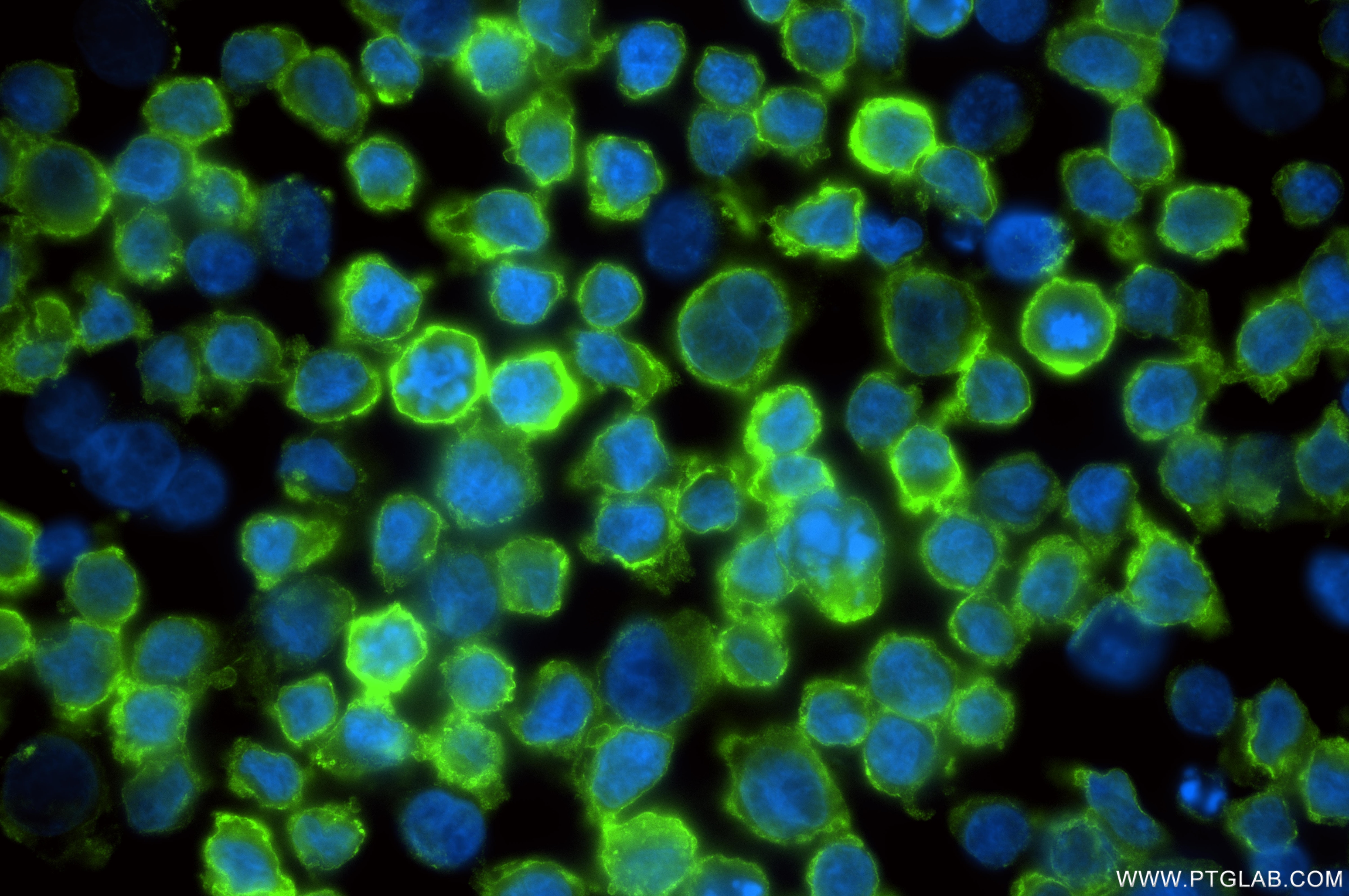 Immunofluorescence (IF) / fluorescent staining of MJ cells using CD25/IL-2RA Recombinant monoclonal antibody (83896-1-RR)