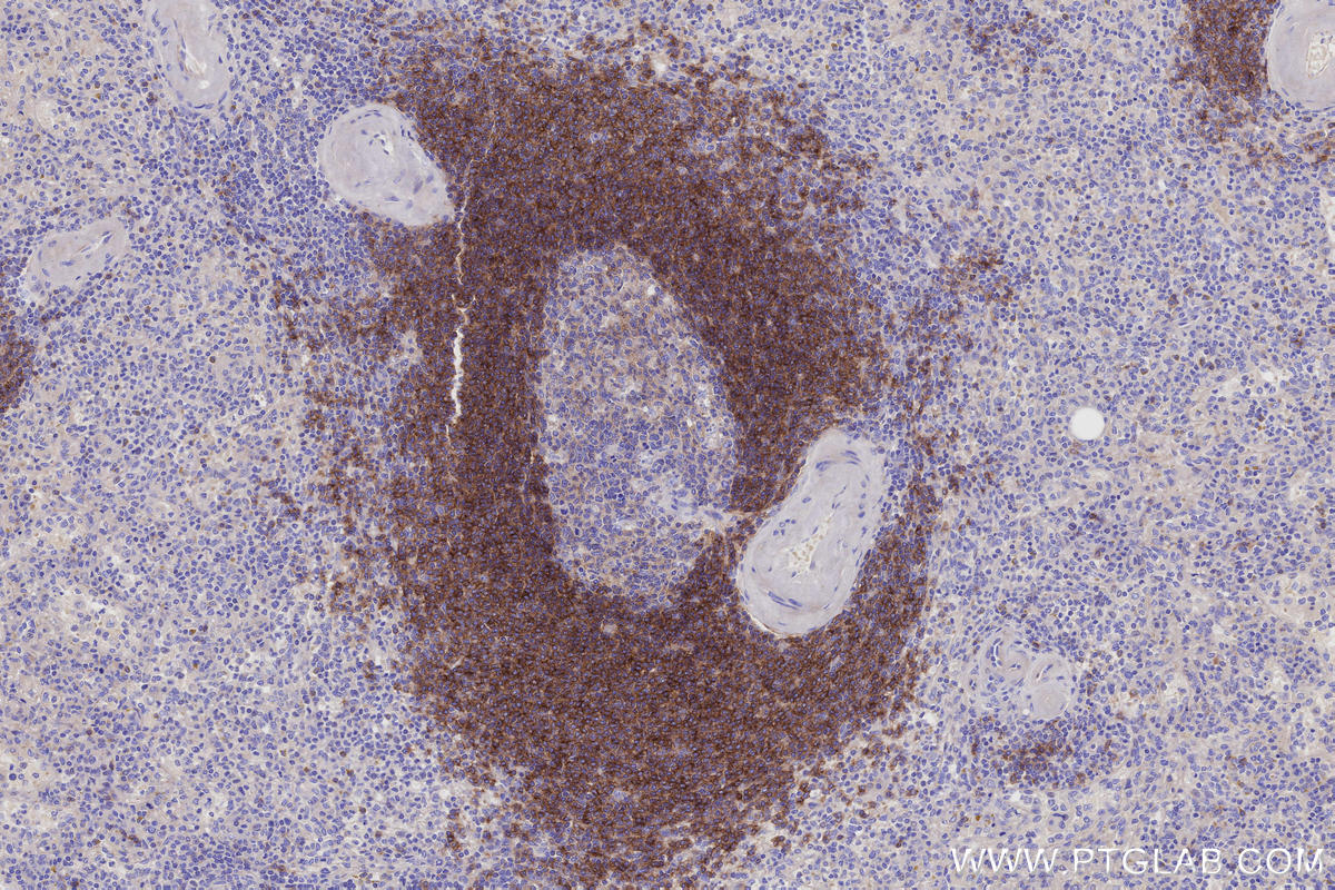 Immunohistochemistry (IHC) staining of human spleen tissue using CD268/BAFF-R Monoclonal antibody (60763-7-Ig)