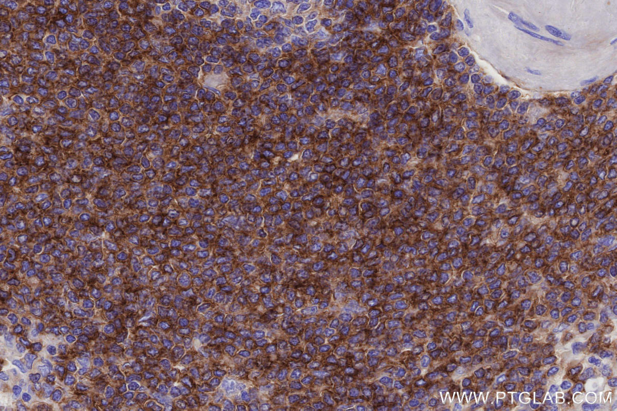 Immunohistochemistry (IHC) staining of human spleen tissue using CD268/BAFF-R Monoclonal antibody (60763-7-Ig)