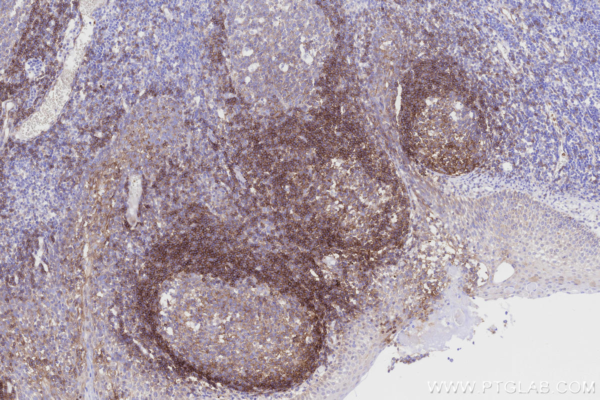Immunohistochemistry (IHC) staining of human tonsillitis tissue using CD268/BAFF-R Monoclonal antibody (60763-7-Ig)