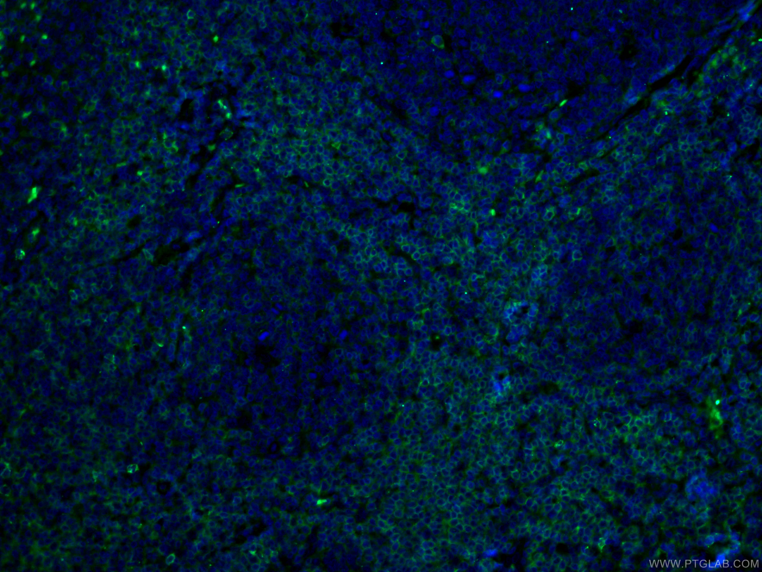 Immunofluorescence (IF) / fluorescent staining of human tonsillitis tissue using CD27 Monoclonal antibody (66308-1-Ig)