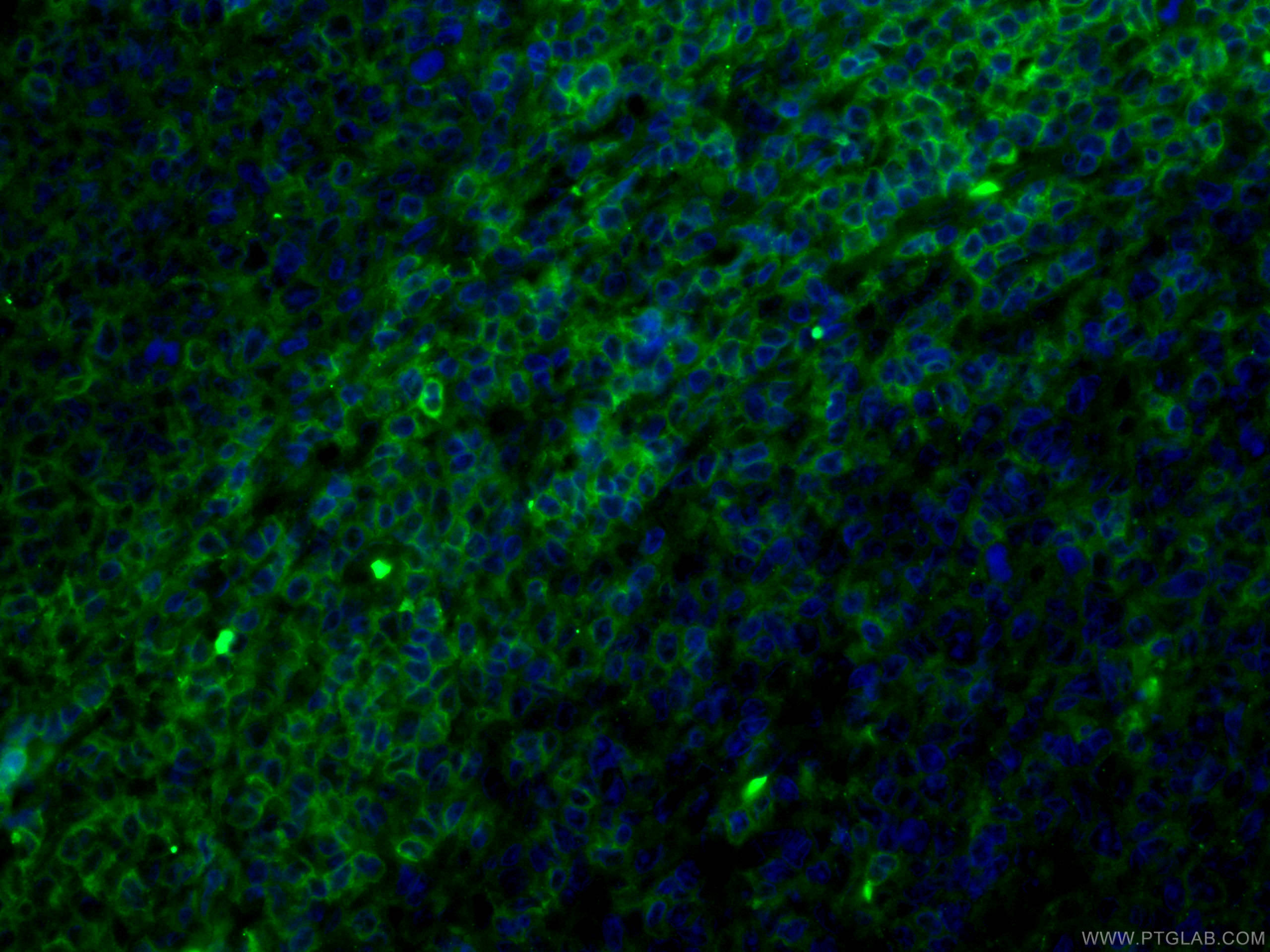 Immunofluorescence (IF) / fluorescent staining of human tonsillitis tissue using CD27 Monoclonal antibody (66308-1-Ig)