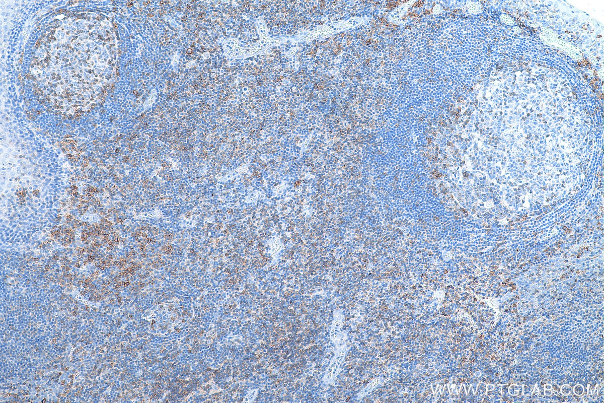 Immunohistochemistry (IHC) staining of human tonsillitis tissue using CD27 Monoclonal antibody (66308-1-Ig)