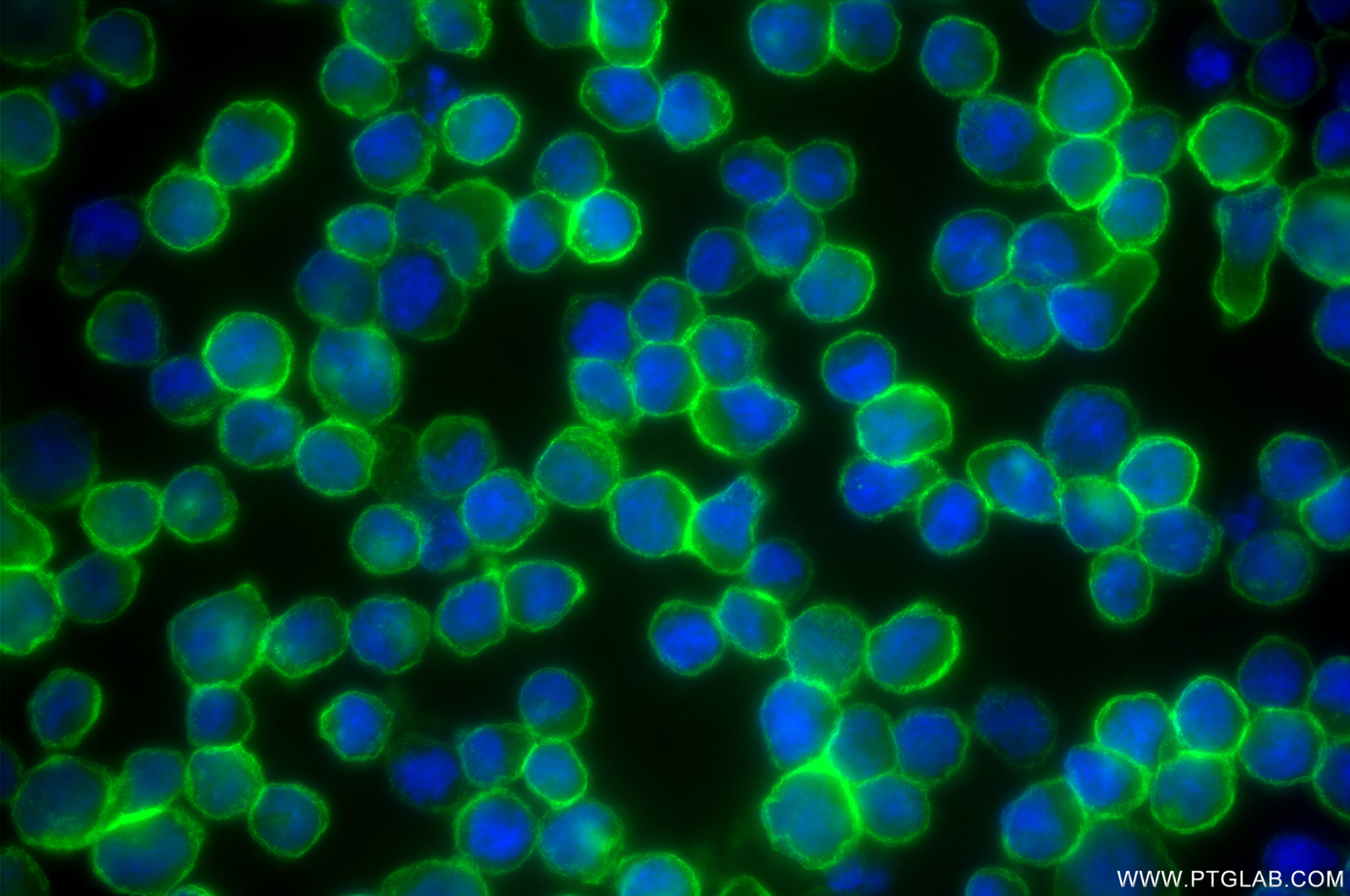 Immunofluorescence (IF) / fluorescent staining of Ramos cells using CD27 Recombinant antibody (85066-5-RR)