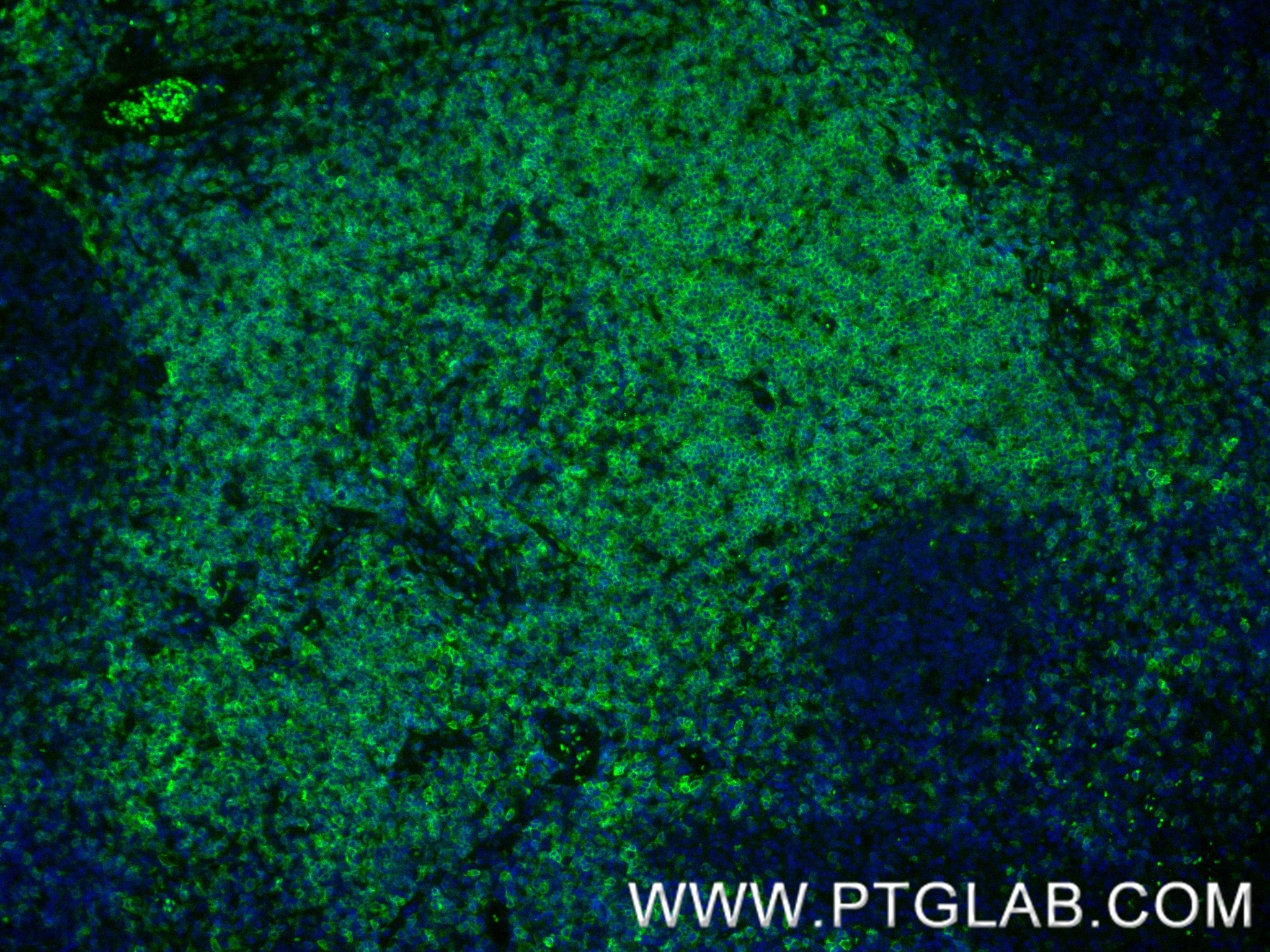 Immunofluorescence (IF) / fluorescent staining of human tonsillitis tissue using CD27 Recombinant antibody (85066-5-RR)