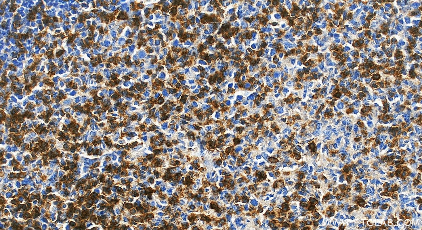 Immunohistochemical analysis of paraffin-embedded human tonsillitis tissue slide using 85066-5-RR (CD27 antibody) at dilution of 1:500 (under 20x lens). Heat mediated antigen retrieval with Tris-EDTA buffer (pH 9.0). Immunohistochemistry (IHC) staining of human tonsillitis tissue using CD27 Recombinant monoclonal antibody (85066-5-RR)