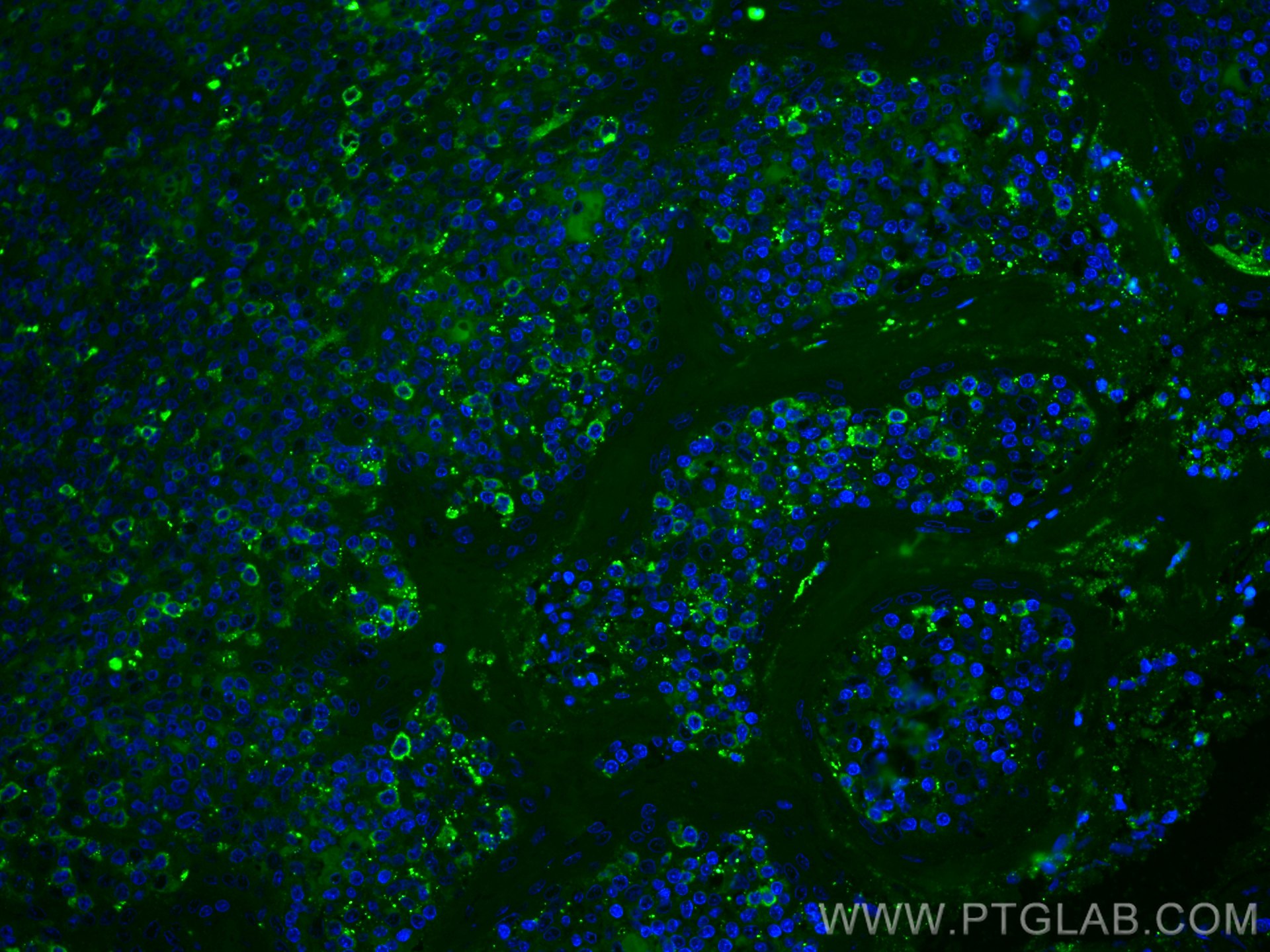 IF Staining of human tonsillitis using CL488-66308