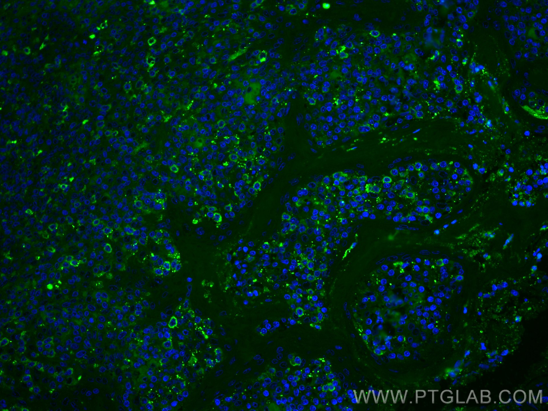 Immunofluorescence (IF) / fluorescent staining of human tonsillitis tissue using CoraLite® Plus 488-conjugated CD27 Monoclonal anti (CL488-66308)