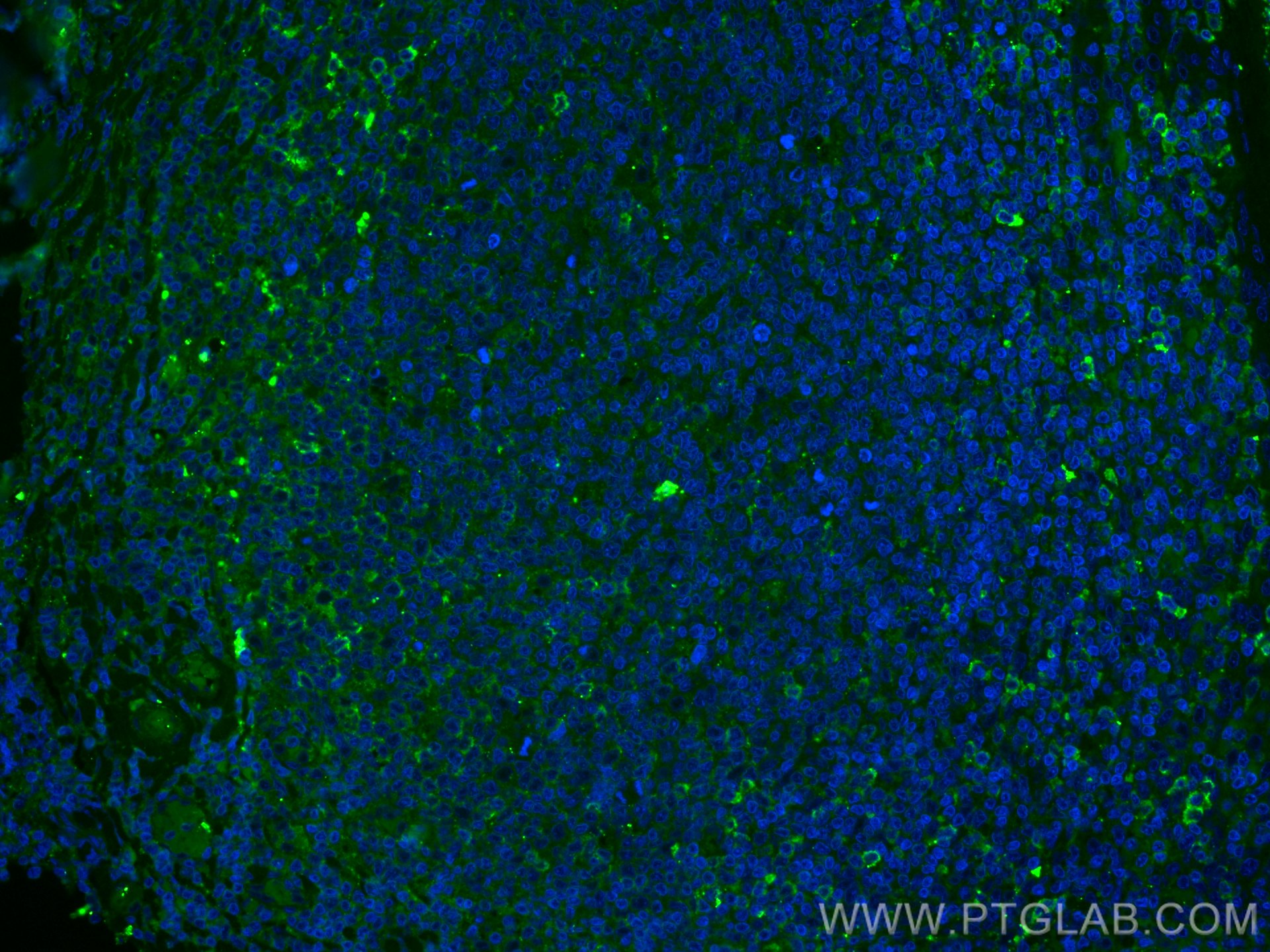 Immunofluorescence (IF) / fluorescent staining of human tonsillitis tissue using CoraLite® Plus 488-conjugated CD27 Monoclonal anti (CL488-66308)