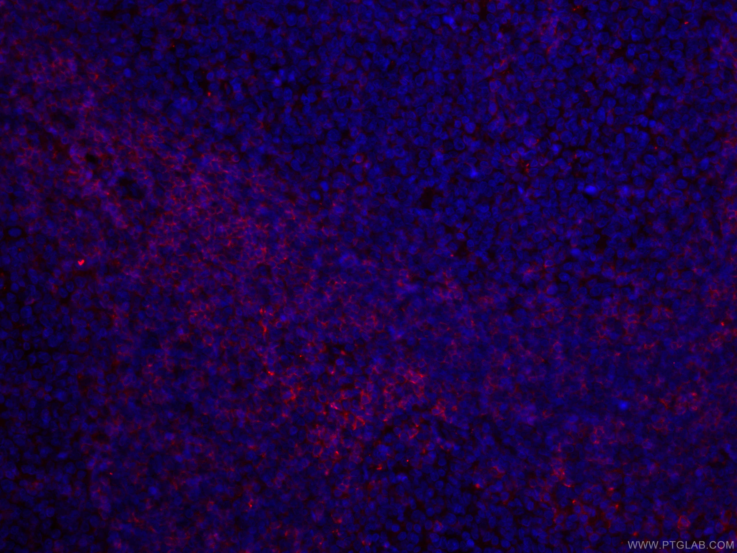Immunofluorescence (IF) / fluorescent staining of human tonsillitis tissue using CoraLite®594-conjugated CD27 Monoclonal antibody (CL594-66308)