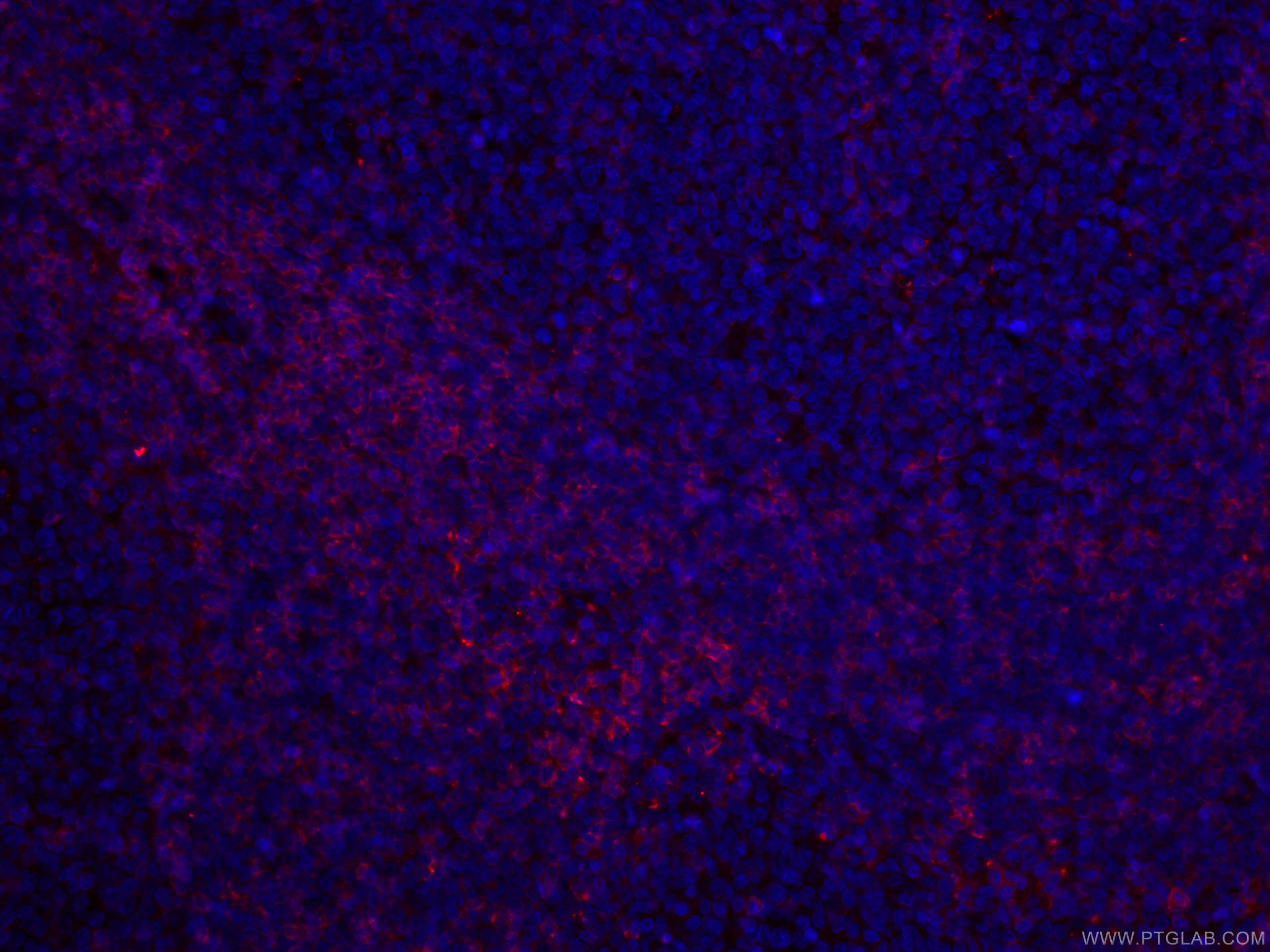 IF Staining of human tonsillitis using CL594-66308