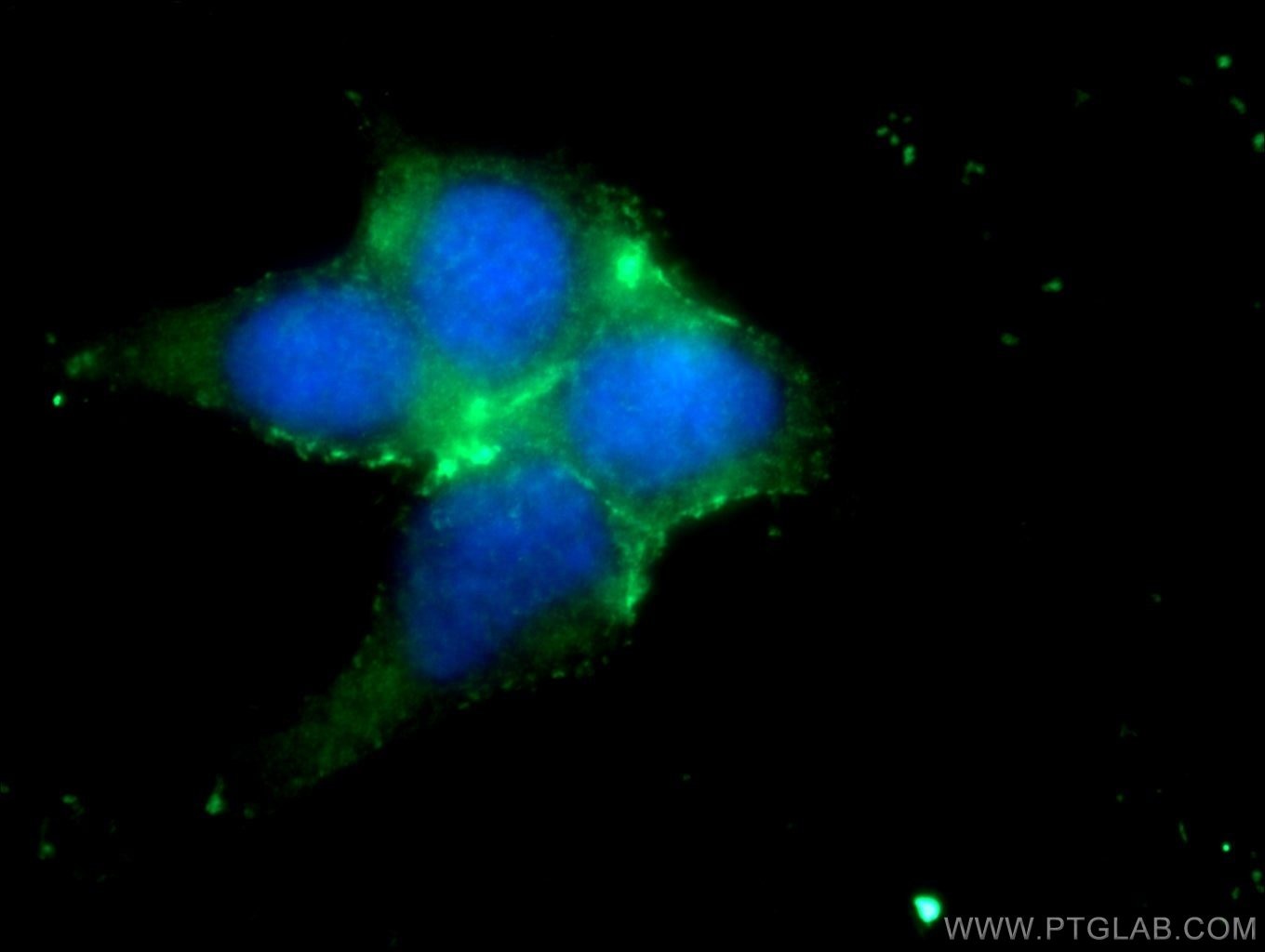 IF Staining of HEK-293 using 17952-1-AP