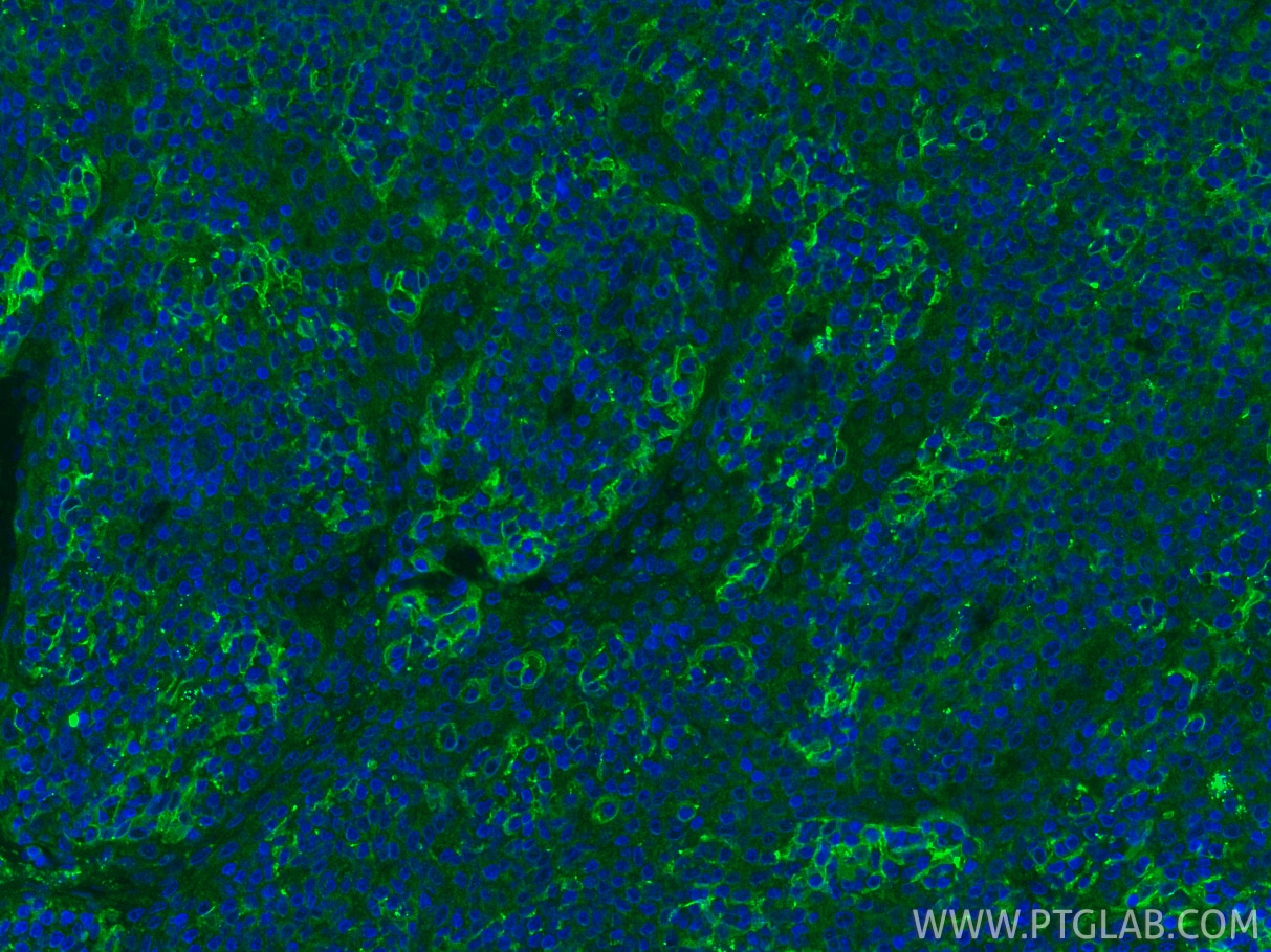 Immunofluorescent analysis of (4% PFA) fixed paraffin-embedded human tonsillitis tissue using PD-L1/CD274 antibody (17952-1-AP) at dilution of 1:200 and CoraLite®488-Conjugated Goat Anti-Rabbit IgG(H+L) (SA00013-2). Heat mediated antigen retrieval with Tris-EDTA buffer (pH 9.0). Immunofluorescence (IF) / fluorescent staining of human tonsillitis tissue using PD-L1/CD274 Polyclonal antibody (17952-1-AP)