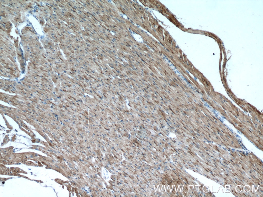 Immunohistochemistry (IHC) staining of mouse heart tissue using PD-L1/CD274 Polyclonal antibody (17952-1-AP)