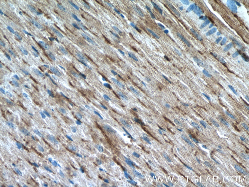 Immunohistochemistry (IHC) staining of mouse heart tissue using PD-L1/CD274 Polyclonal antibody (17952-1-AP)