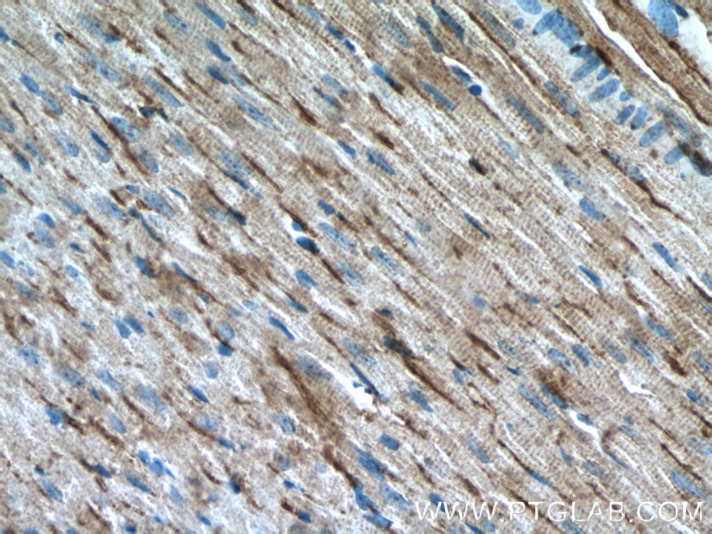 PD-L1/CD274 Polyclonal antibody