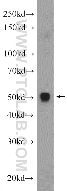 PD-L1/CD274 Polyclonal antibody