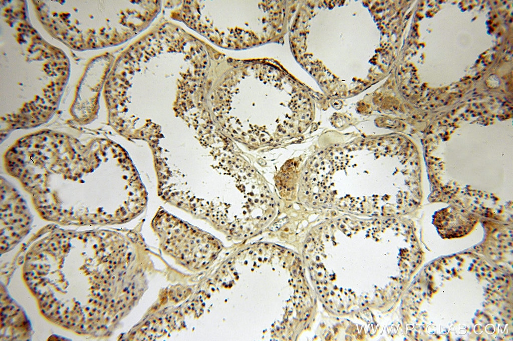 Immunohistochemistry (IHC) staining of human testis tissue using B7-H3 Polyclonal antibody (14453-1-AP)