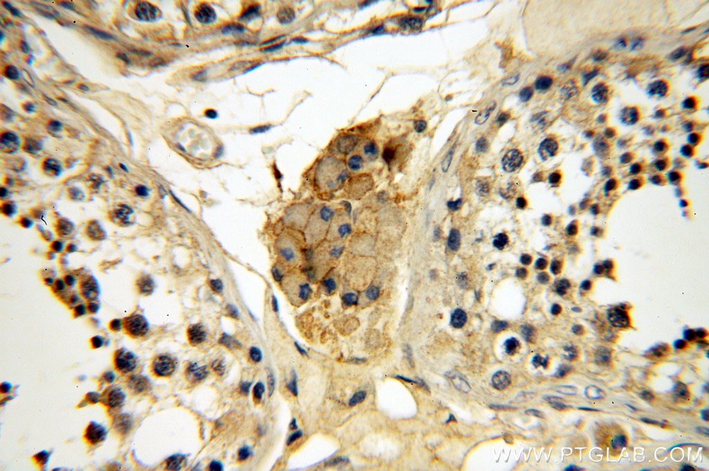 IHC staining of human testis using 14453-1-AP