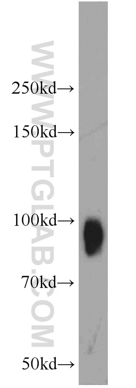 Western Blot (WB) analysis of HEK-293 cells using B7-H3 Polyclonal antibody (14453-1-AP)