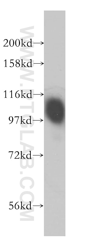 Western Blot (WB) analysis of PC-3 cells using B7-H3 Polyclonal antibody (14453-1-AP)