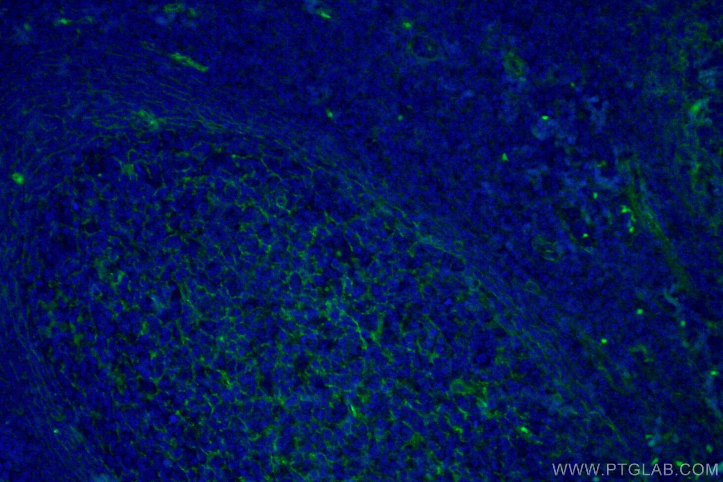 Immunofluorescence (IF) / fluorescent staining of human tonsillitis tissue using B7-H3 Monoclonal antibody (66481-1-Ig)
