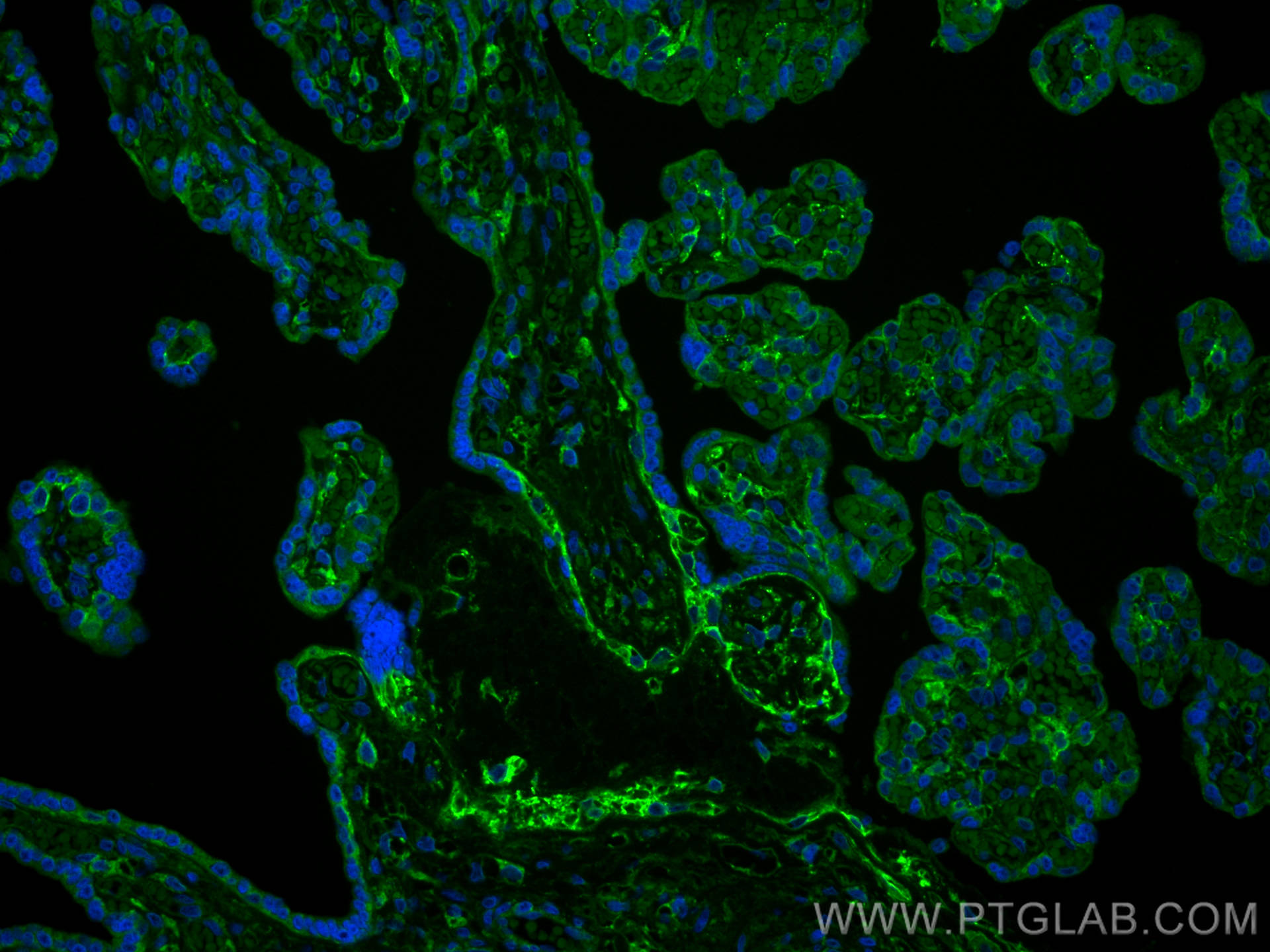 Immunofluorescence (IF) / fluorescent staining of human placenta tissue using B7-H3 Monoclonal antibody (66481-1-Ig)