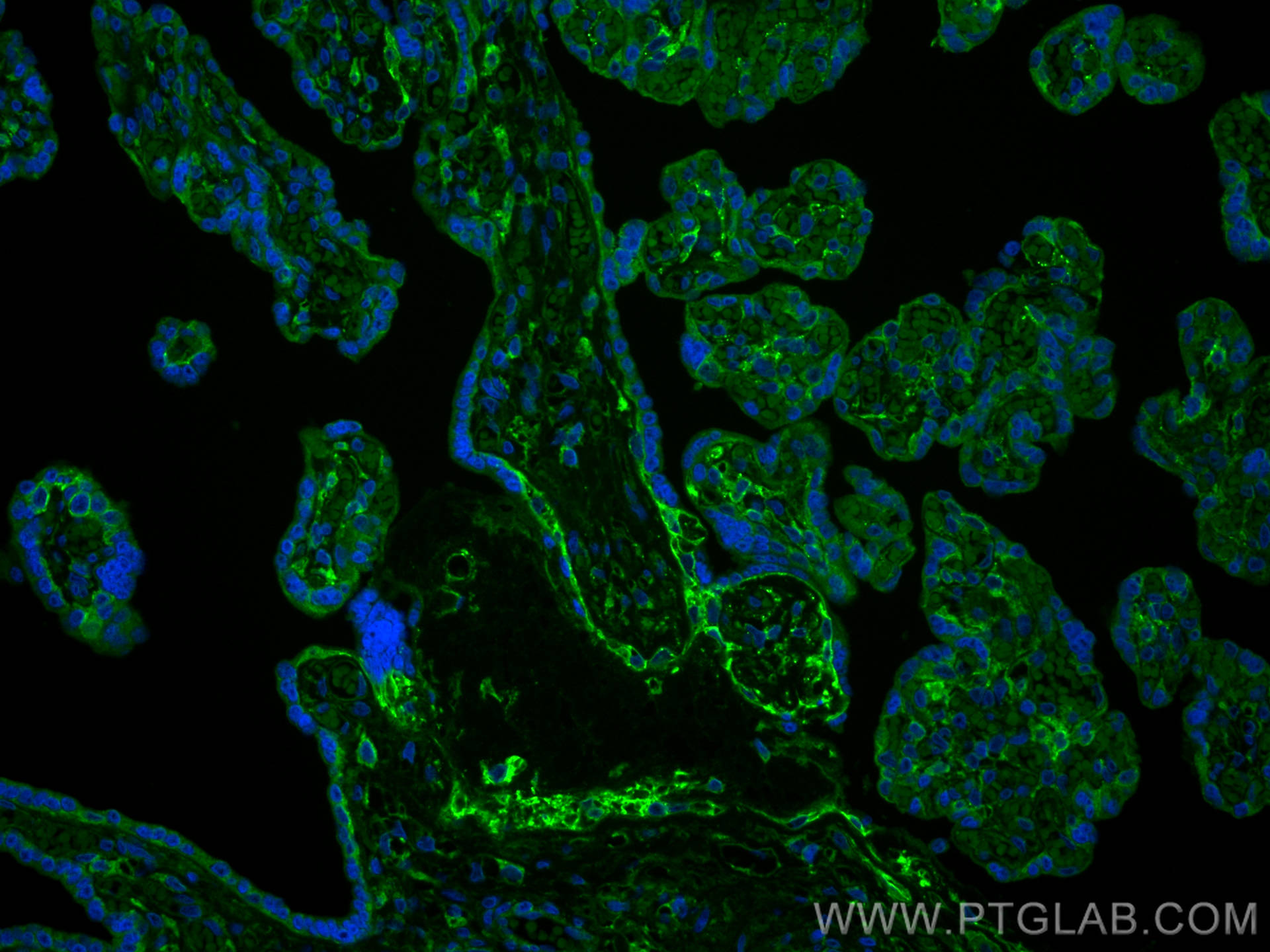 IF Staining of human placenta using 66481-1-Ig