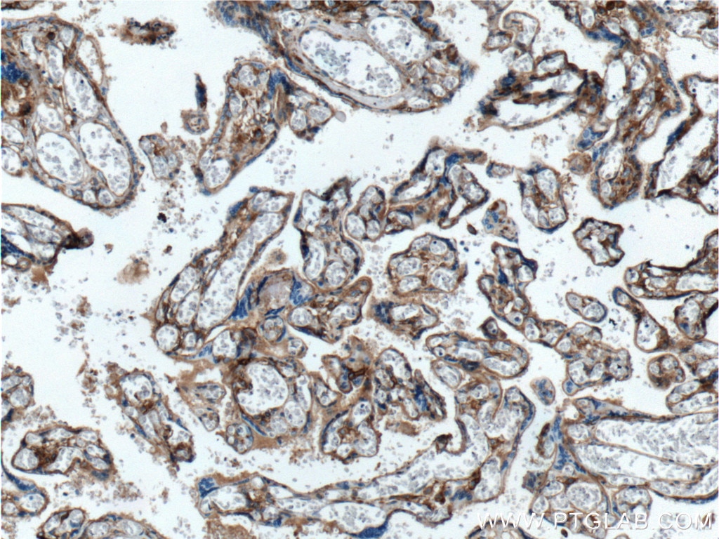 Immunohistochemistry (IHC) staining of human placenta tissue using B7-H3/CD276 Monoclonal antibody (66481-1-Ig)