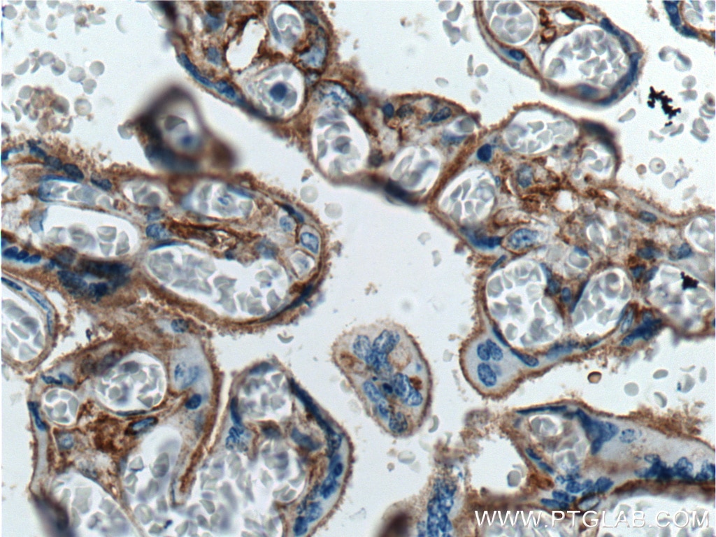 Immunohistochemistry (IHC) staining of human placenta tissue using B7-H3/CD276 Monoclonal antibody (66481-1-Ig)