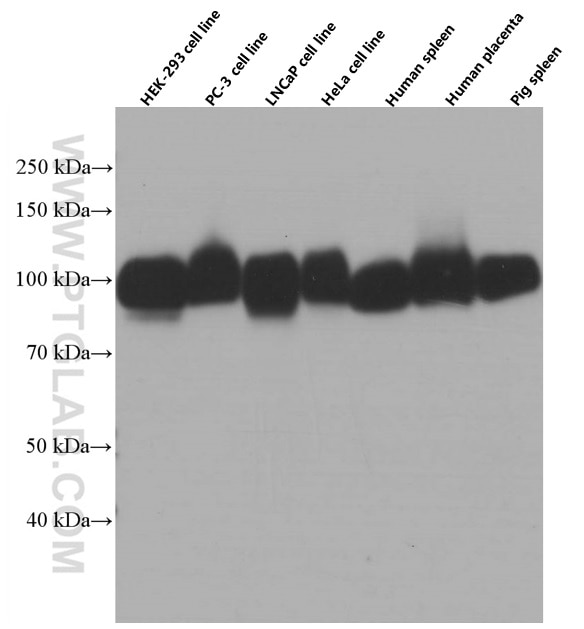 Western Blot (WB) analysis of HEK-293 cells using B7-H3 Monoclonal antibody (66481-1-Ig)