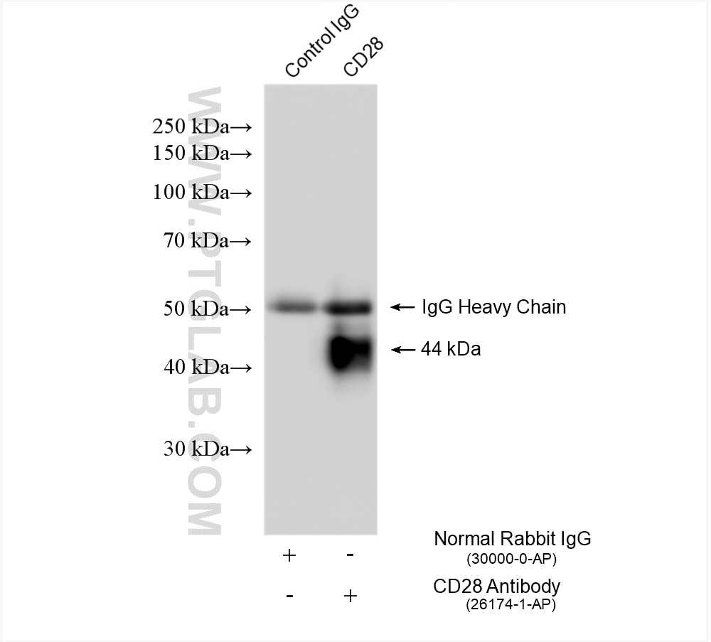 Immunoprecipitation (IP) experiment of Jurkat cells using CD28 Polyclonal antibody (26174-1-AP)