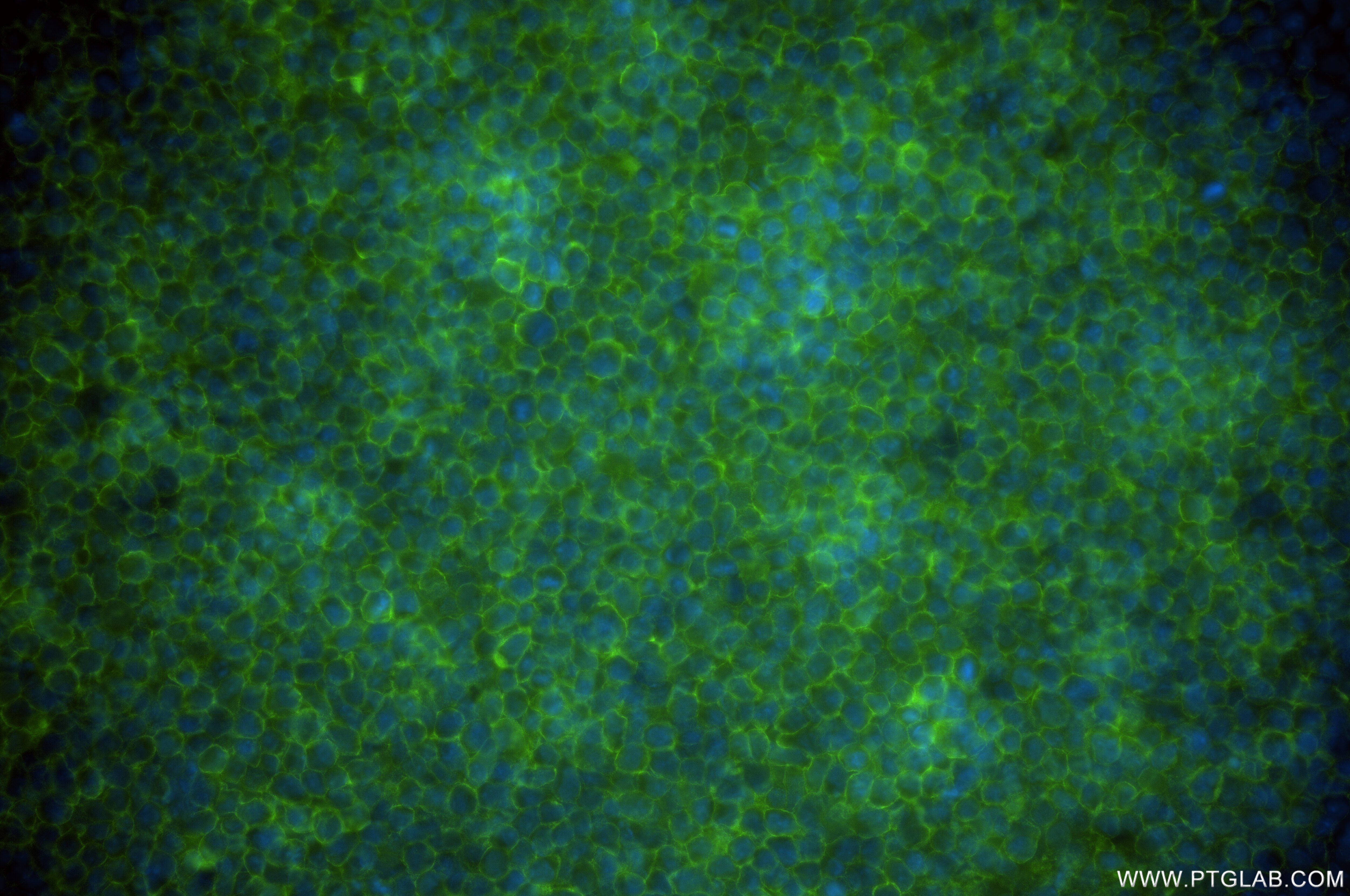 Immunofluorescence (IF) / fluorescent staining of EL-4-B5 cells using CD28 Recombinant antibody (84368-4-RR)