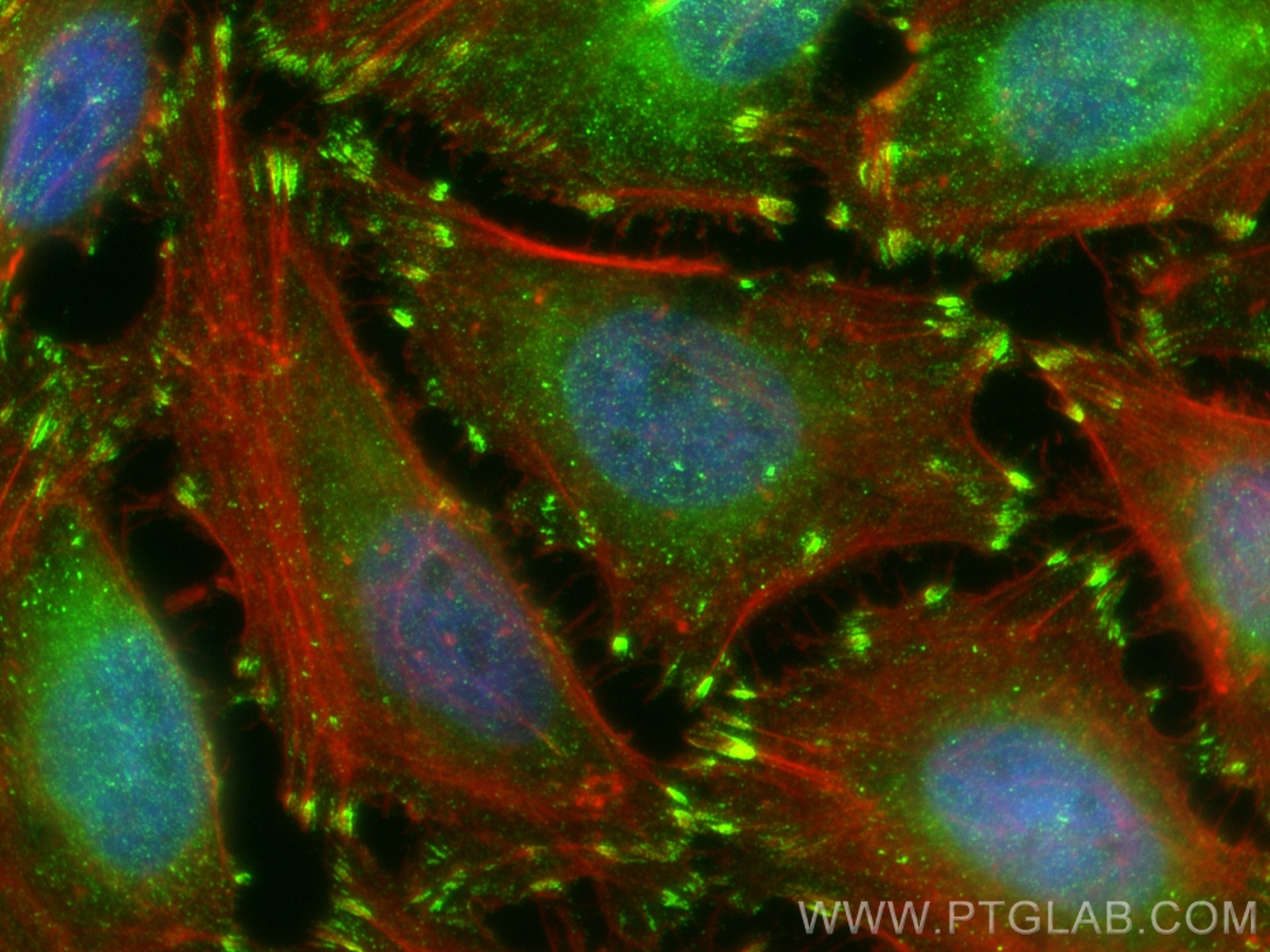 Immunofluorescence (IF) / fluorescent staining of HeLa cells using CD29 Recombinant antibody (85005-1-RR)