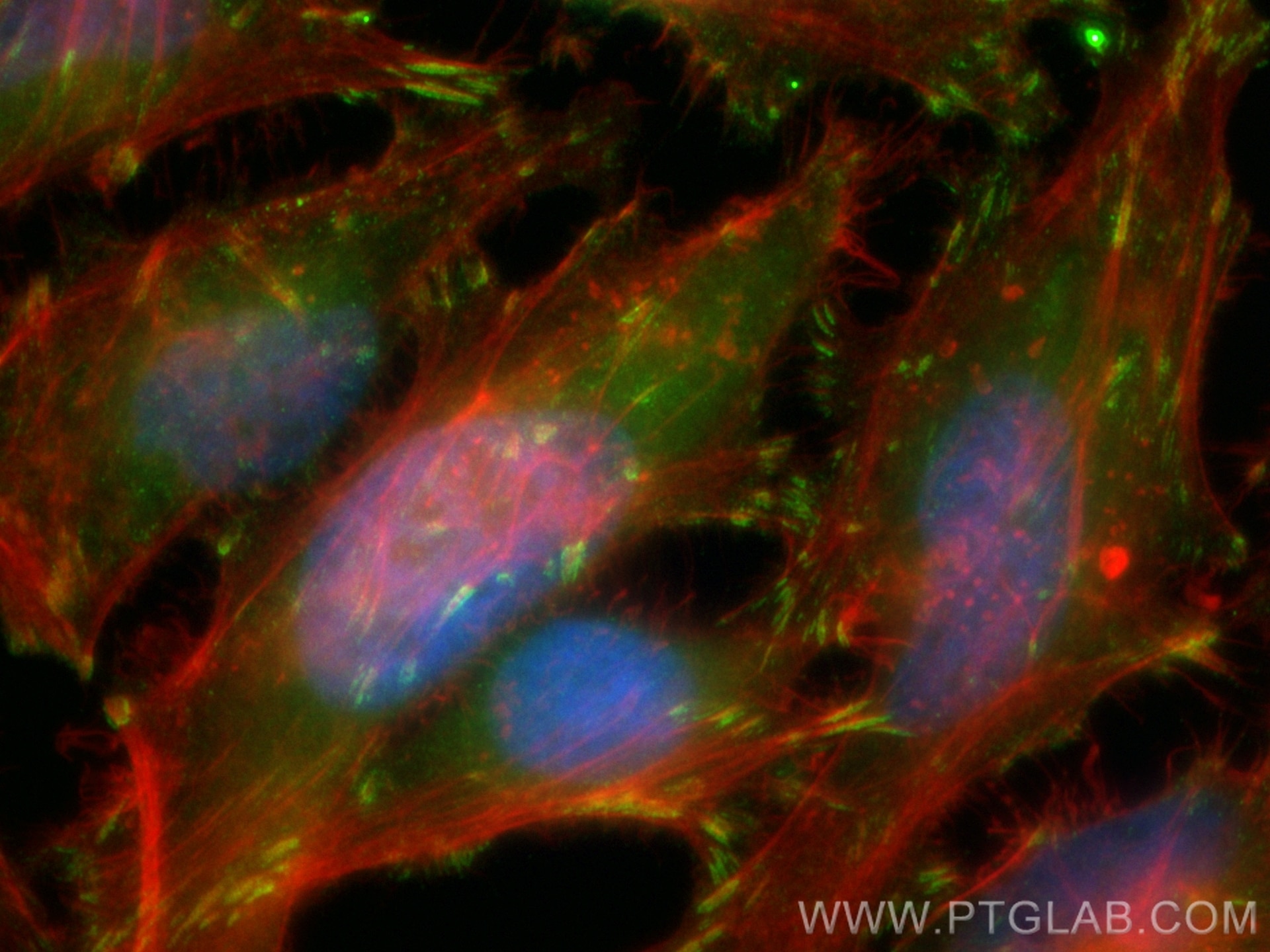 Immunofluorescence (IF) / fluorescent staining of HeLa cells using CoraLite® Plus 488-conjugated CD29 Recombinant ant (CL488-85005)