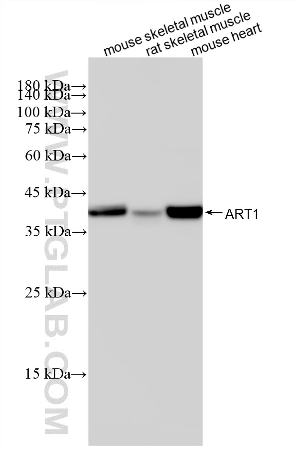 Various lysates were subjected to SDS PAGE followed by western blot with 87577-1-RR (CD296/ART1 antibody) at dilution of 1:10000 incubated at room temperature for 1.5 hours. This data was developed using the same antibody clone with 87577-1-PBS in a different storage buffer formulation. Western Blot (WB) analysis of various lysates using CD296/ART1 Recombinant monoclonal antibody (87577-1-RR)