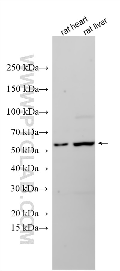 Western Blot (WB) analysis of various lysates using CD297/ART4 Polyclonal antibody (33949-1-AP)