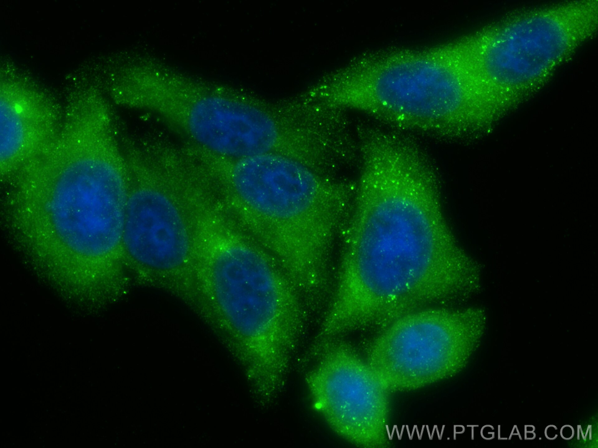 Immunofluorescence (IF) / fluorescent staining of HepG2 cells using CD2AP Polyclonal antibody (32089-1-AP)