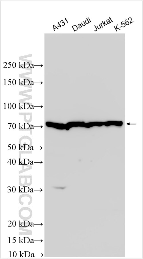 Western Blot (WB) analysis of various lysates using CD2AP Polyclonal antibody (32089-1-AP)