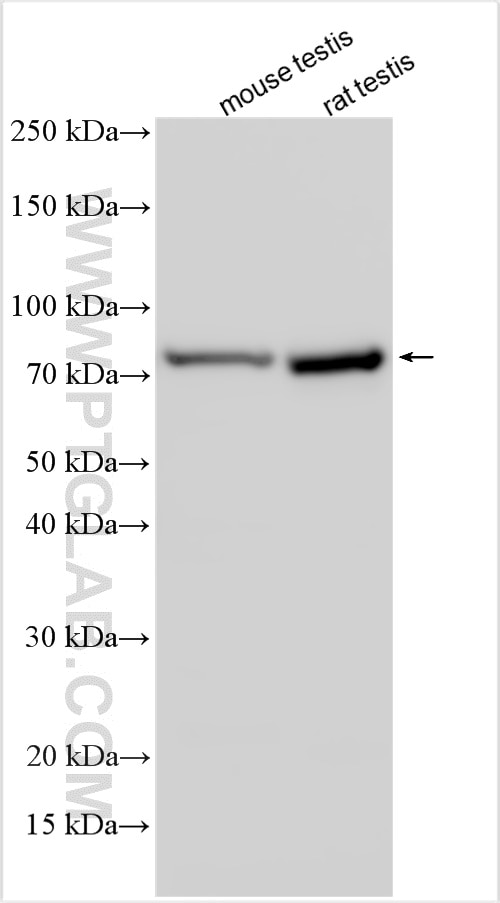 Western Blot (WB) analysis of various lysates using CD2AP Polyclonal antibody (32089-1-AP)