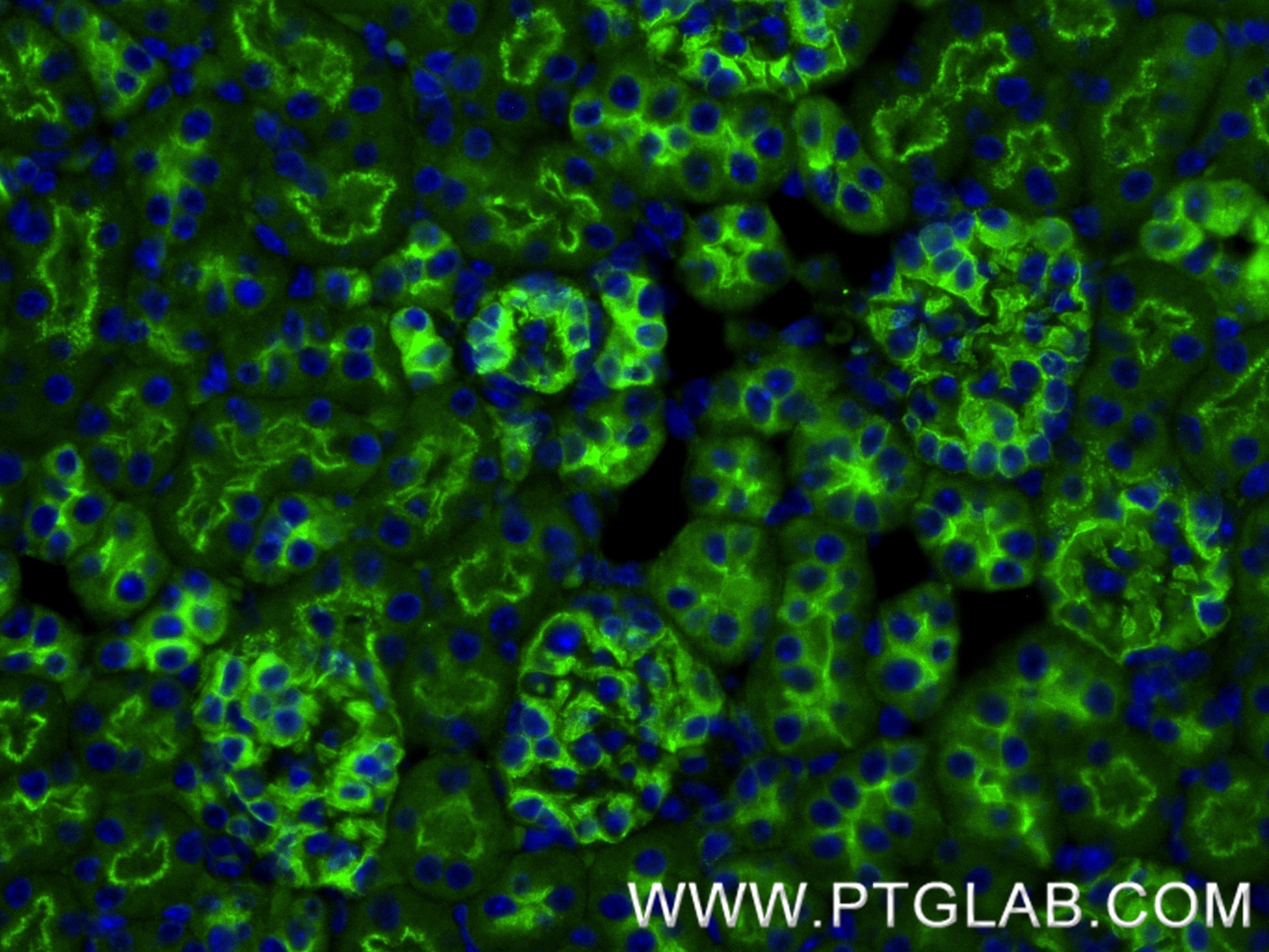Immunofluorescence (IF) / fluorescent staining of mouse kidney tissue using CD2AP Recombinant monoclonal antibody (86727-1-RR)