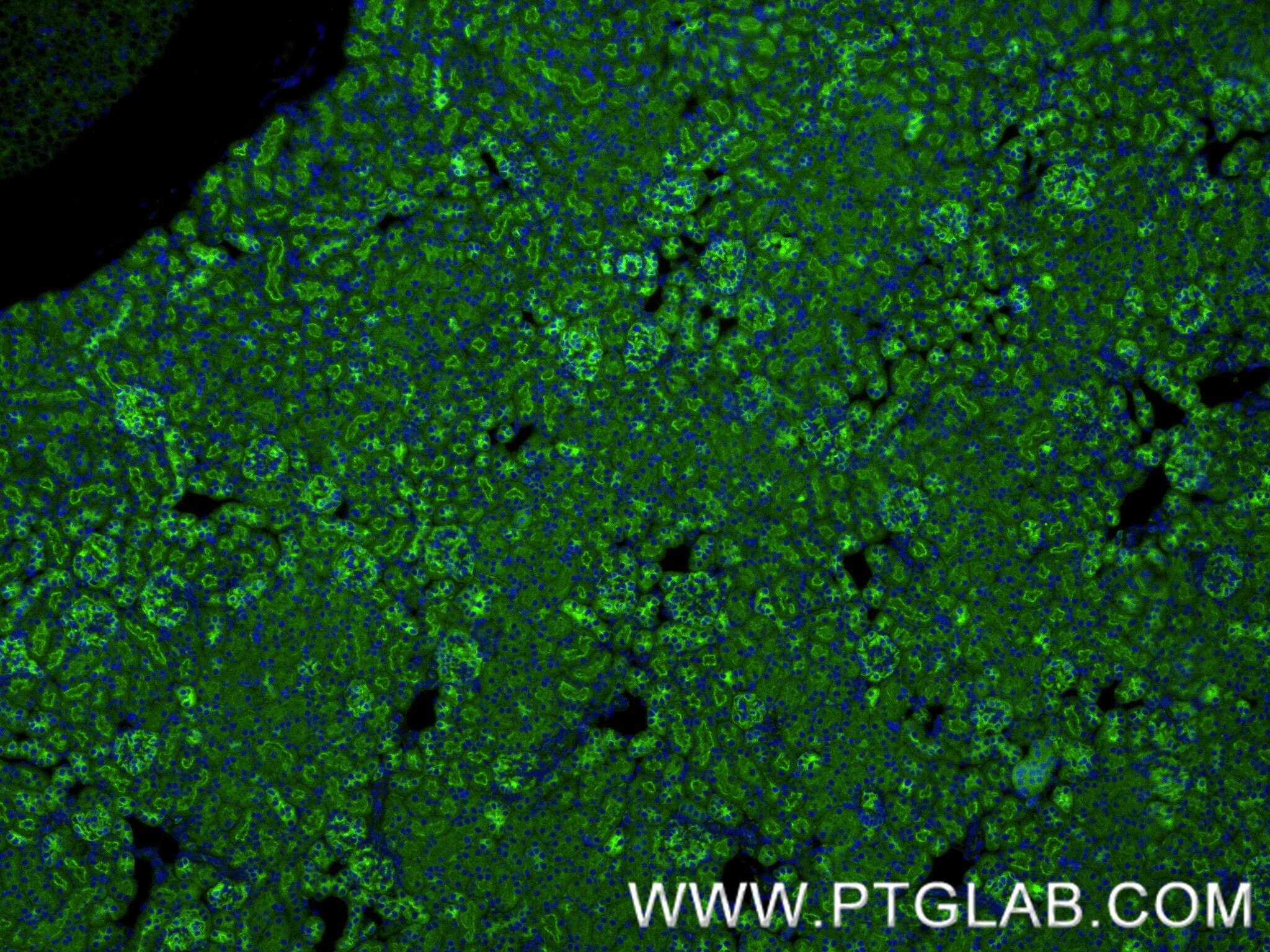 Immunofluorescence (IF) / fluorescent staining of mouse kidney tissue using CD2AP Recombinant monoclonal antibody (86727-1-RR)