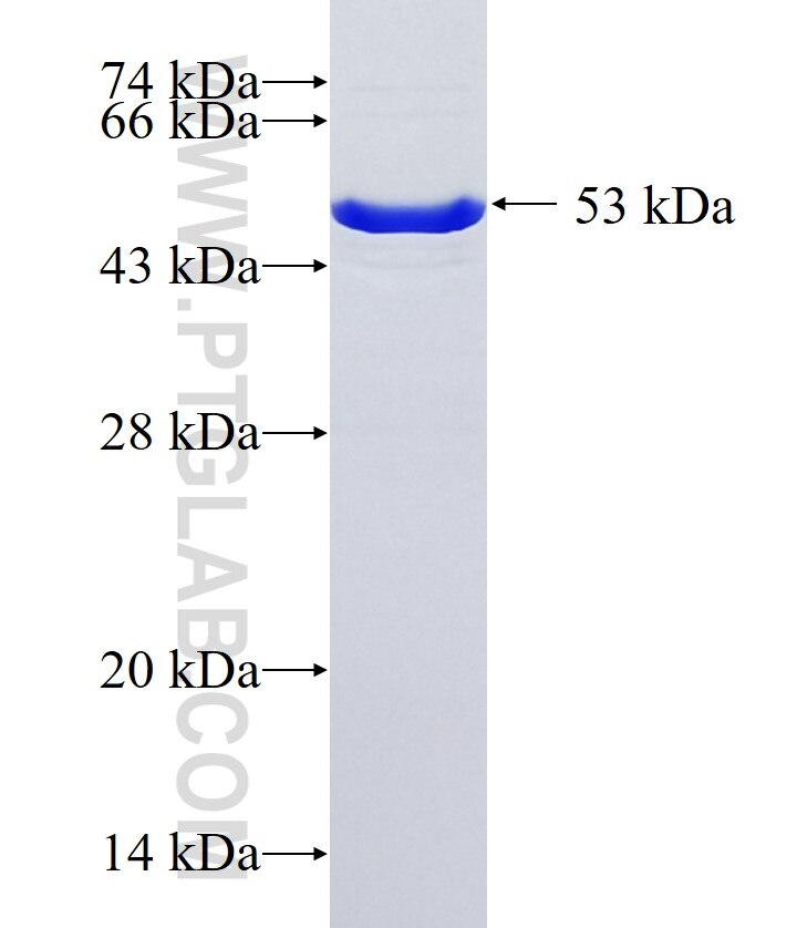 CD2AP fusion protein Ag36919 SDS-PAGE