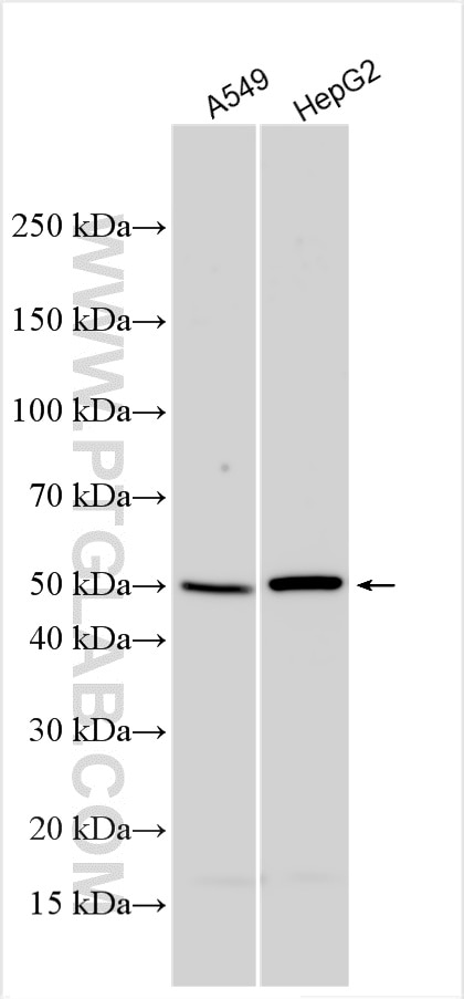 Western Blot (WB) analysis of various lysates using CD2BP2 Polyclonal antibody (32930-1-AP)