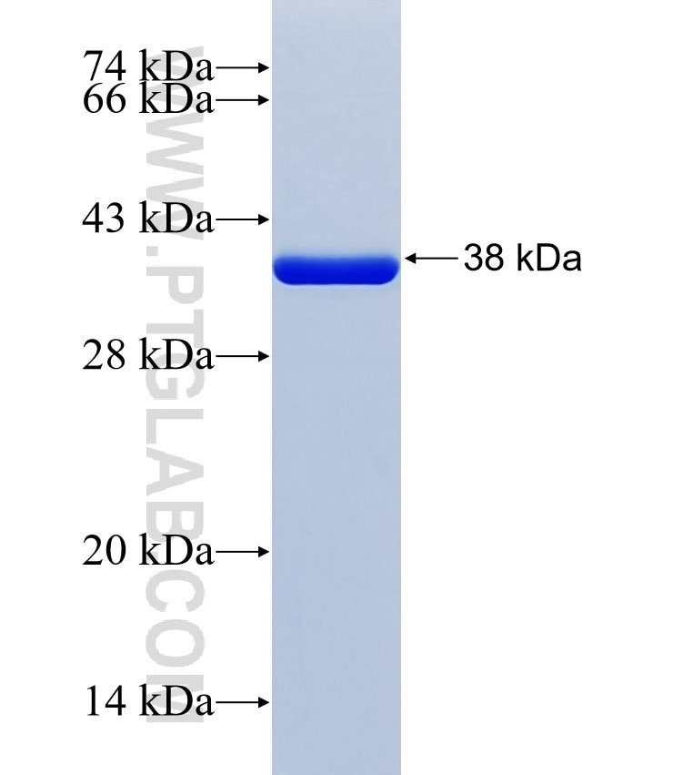 CD2BP2 fusion protein Ag38662 SDS-PAGE