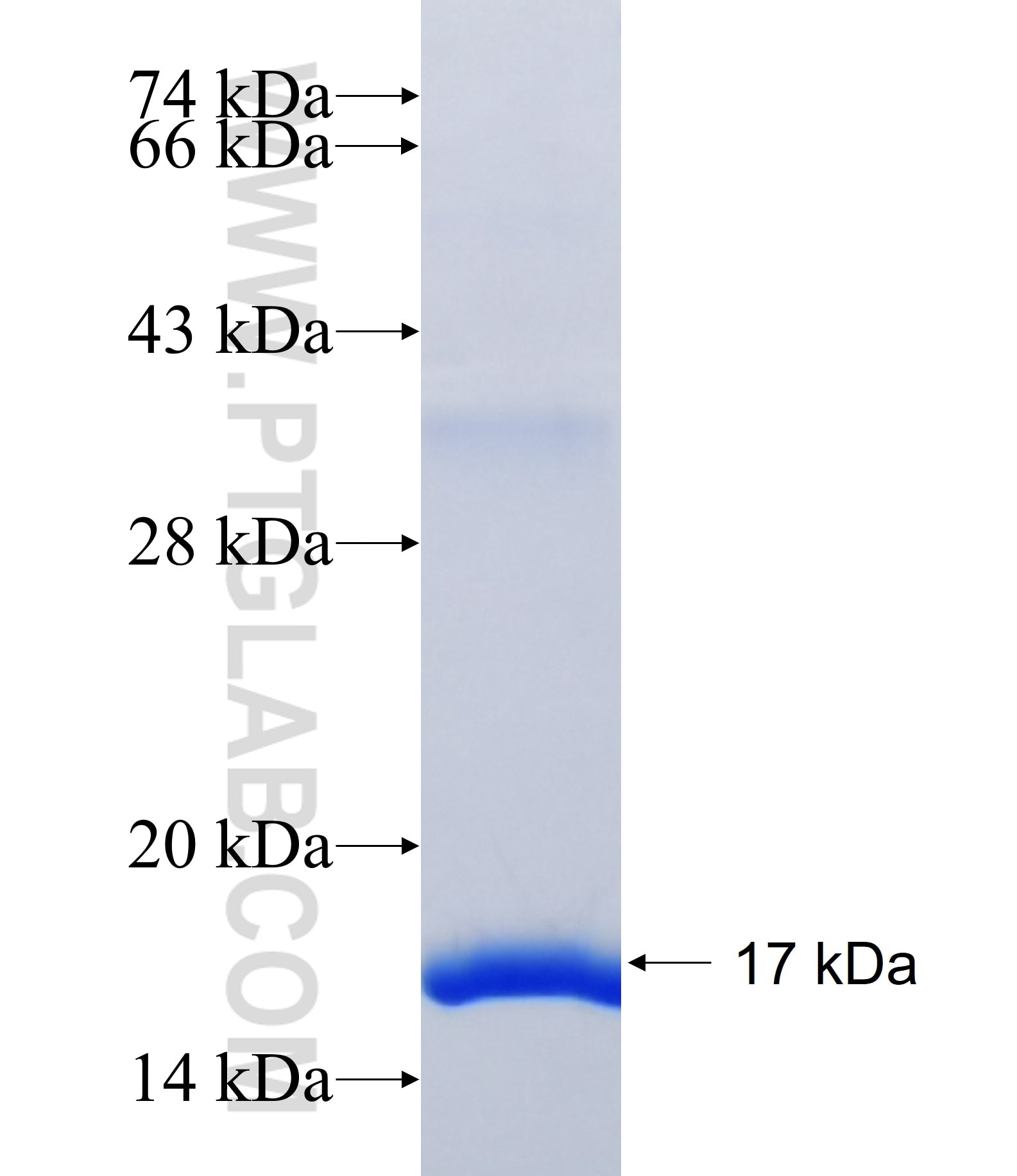 CD2BP2 fusion protein Ag38673 SDS-PAGE CD2BP2 fusion protein Ag38673 SDS-PAGE