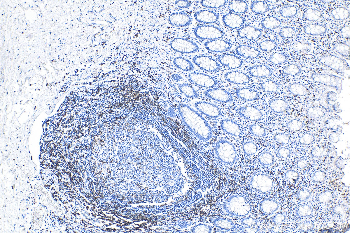 Immunohistochemistry (IHC) staining of human colon tissue using CD3 Recombinant antibody (81324-1-RR)