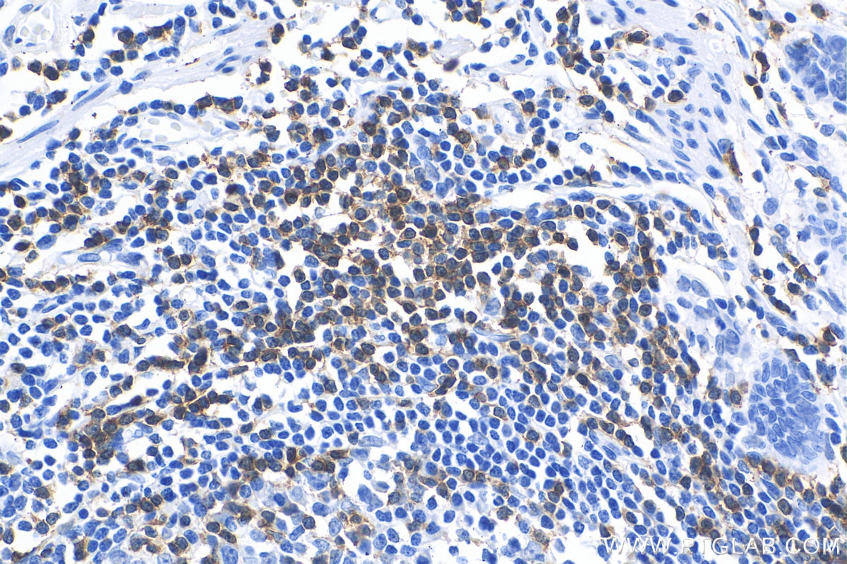 Immunohistochemistry (IHC) staining of human colon tissue using CD3 Recombinant antibody (81324-1-RR)