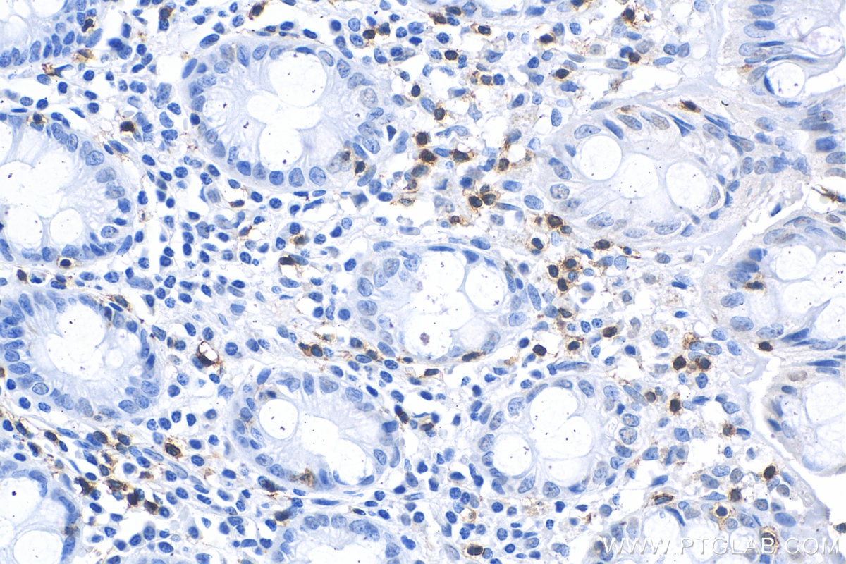 Immunohistochemistry (IHC) staining of human colon tissue using CD3 Recombinant antibody (81324-1-RR)