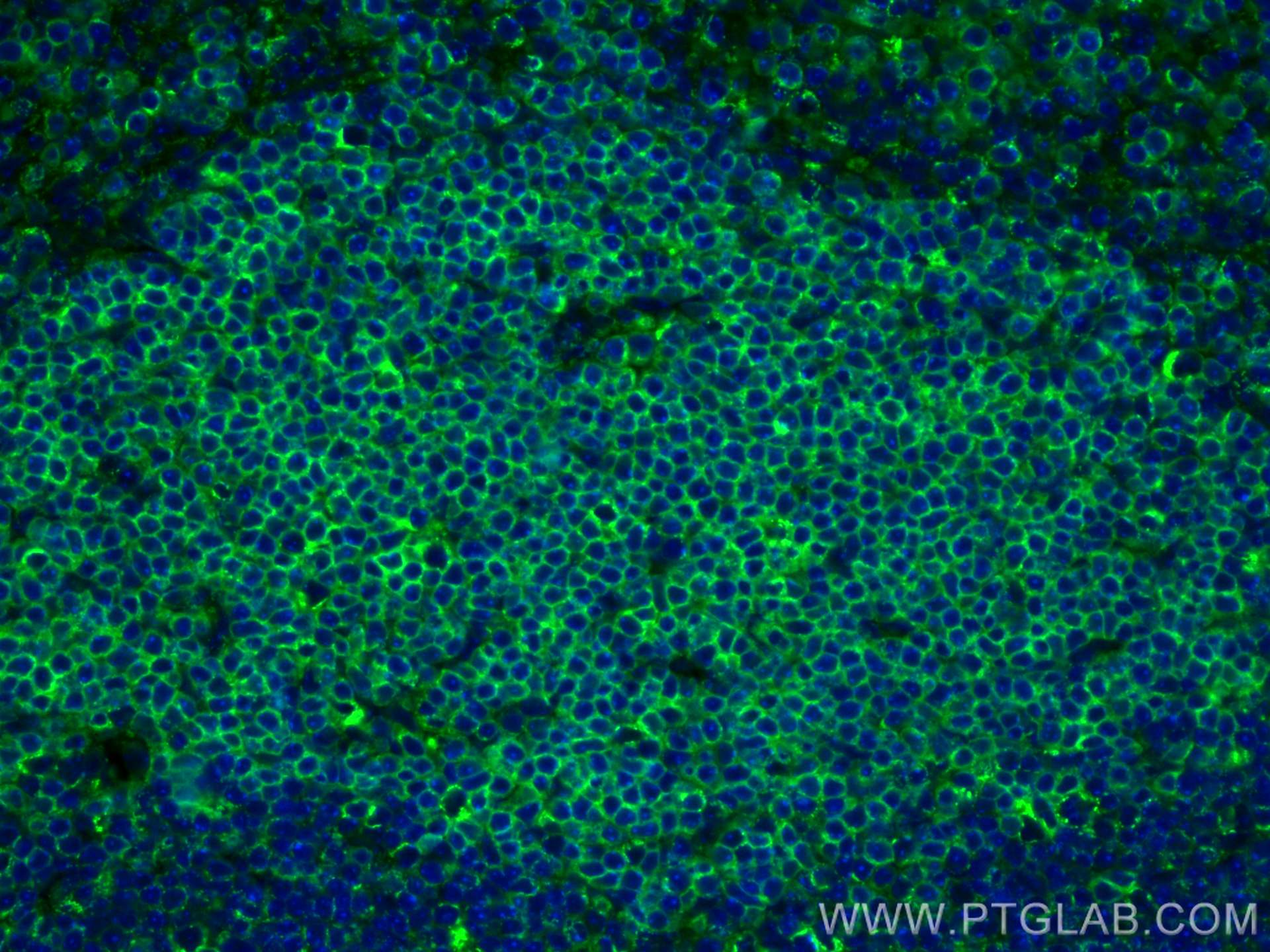 Immunofluorescence (IF) / fluorescent staining of mouse spleen tissue using CoraLite® Plus 488-conjugated human CD3 Polyclonal (CL488-17617)